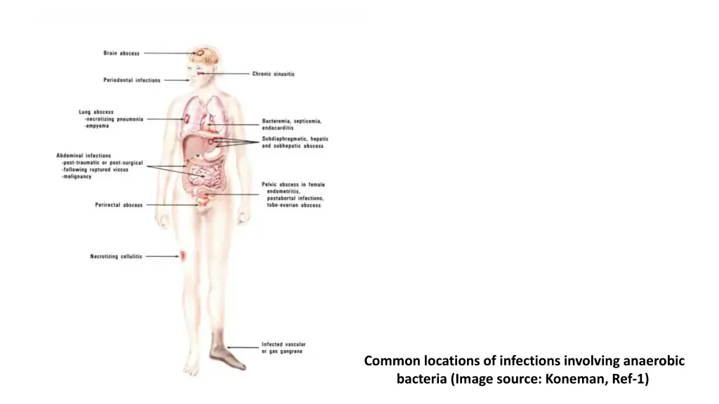 common locations of infections involving