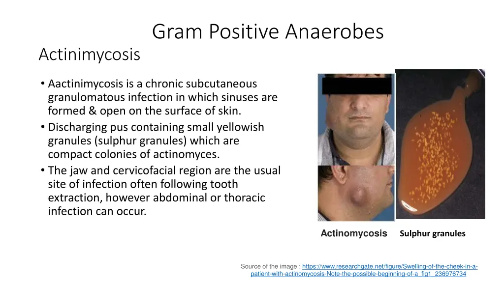 gram positive anaerobes 1