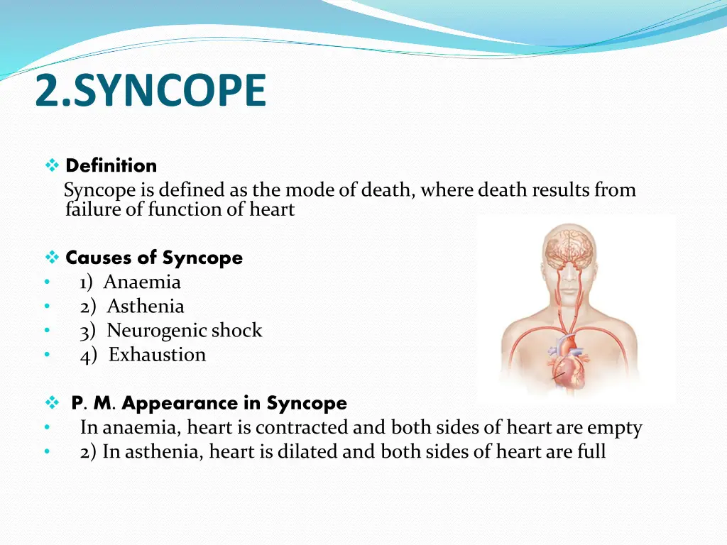 2 syncope