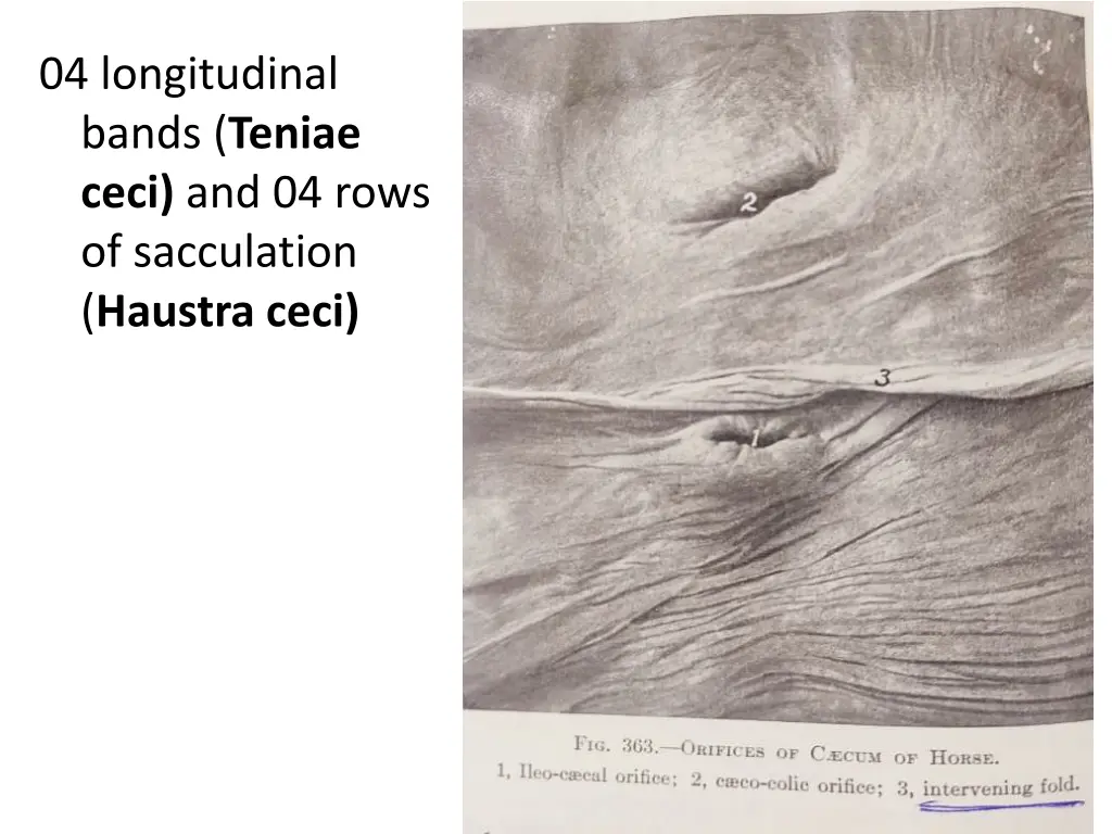 04 longitudinal bands teniae ceci and 04 rows