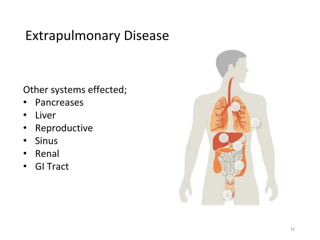 extrapulmonary disease