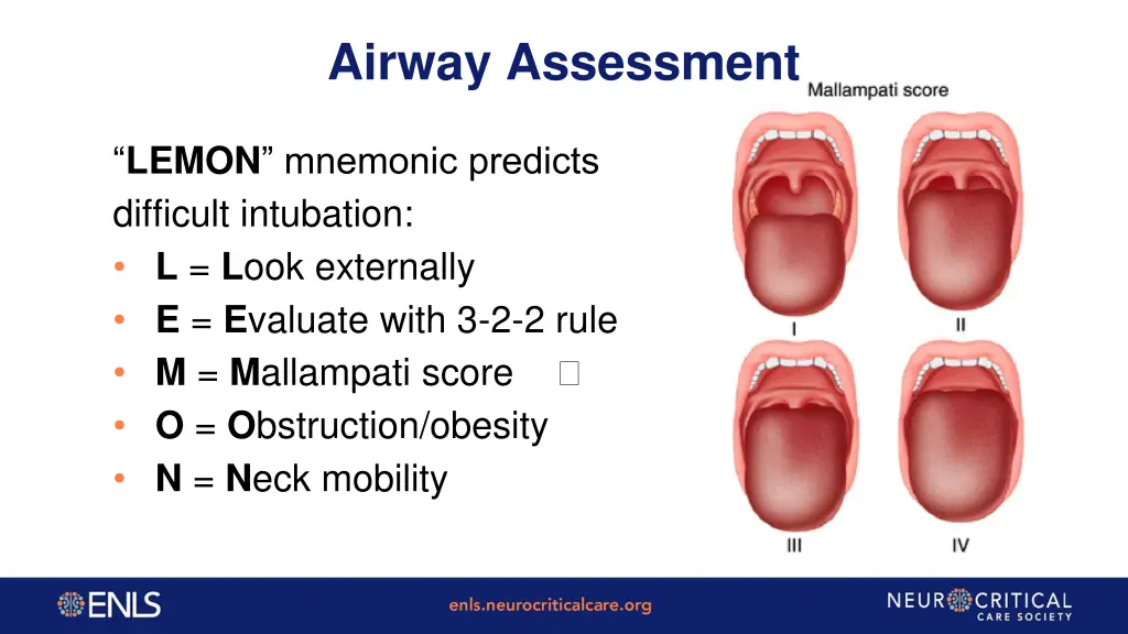 airway assessment