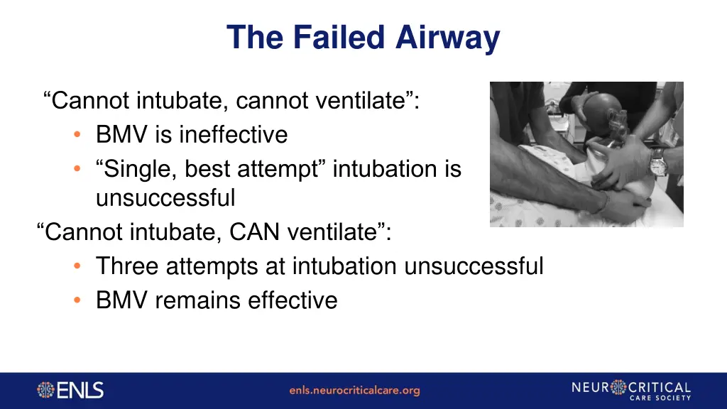 the failed airway