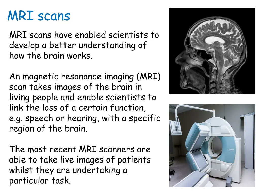 mri scans mri scans have enabled scientists