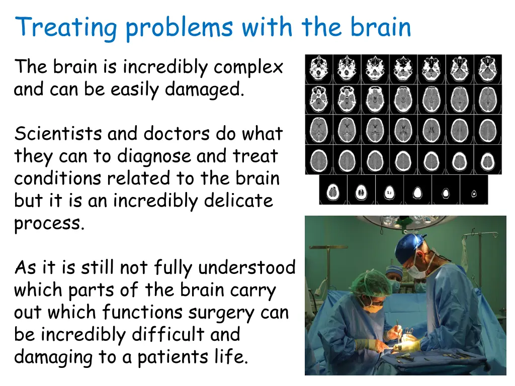 treating problems with the brain the brain