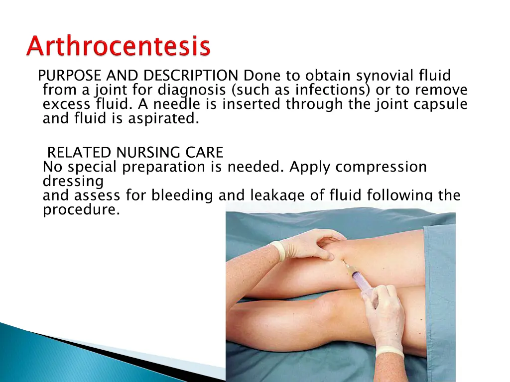 purpose and description done to obtain synovial