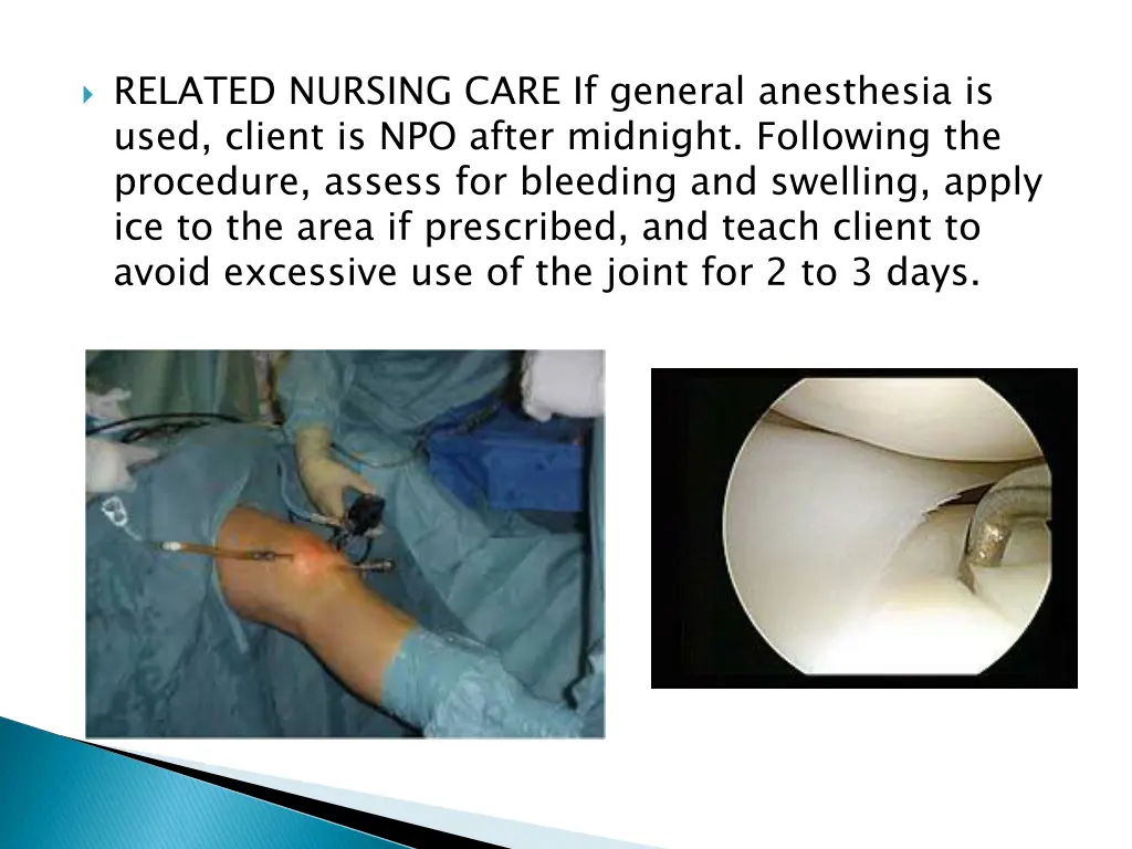 related nursing care if general anesthesia