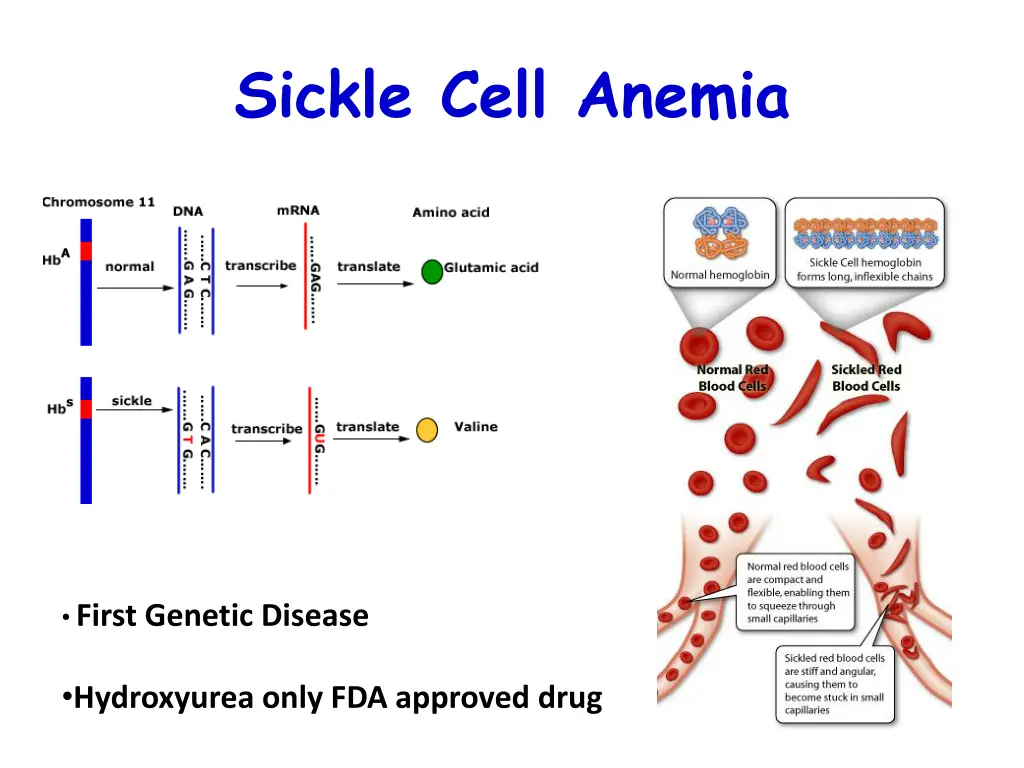 sickle cell anemia