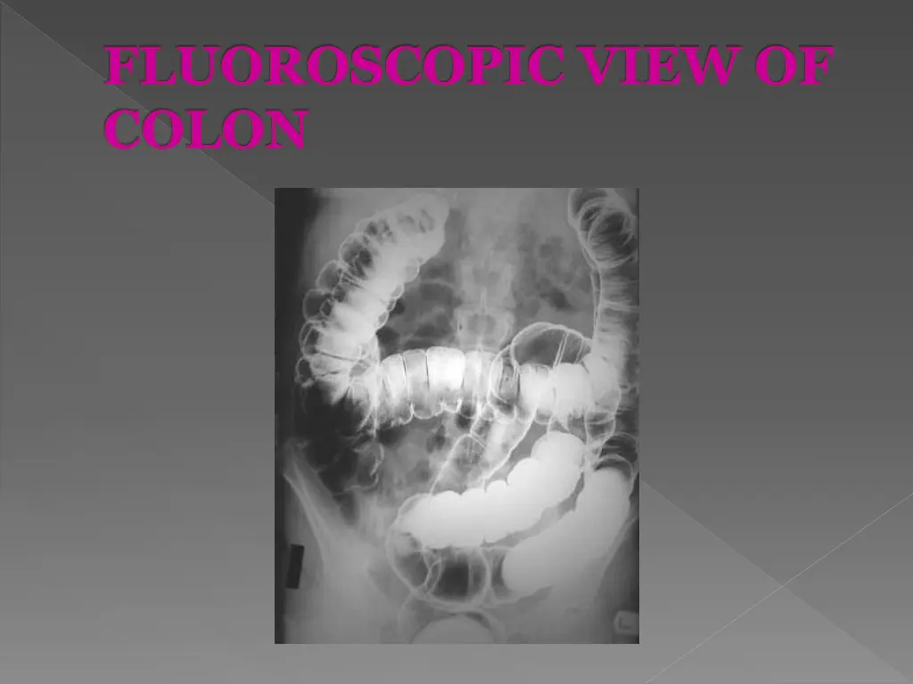 fluoroscopic view of colon