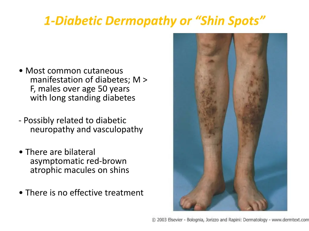 1 diabetic dermopathy or shin spots