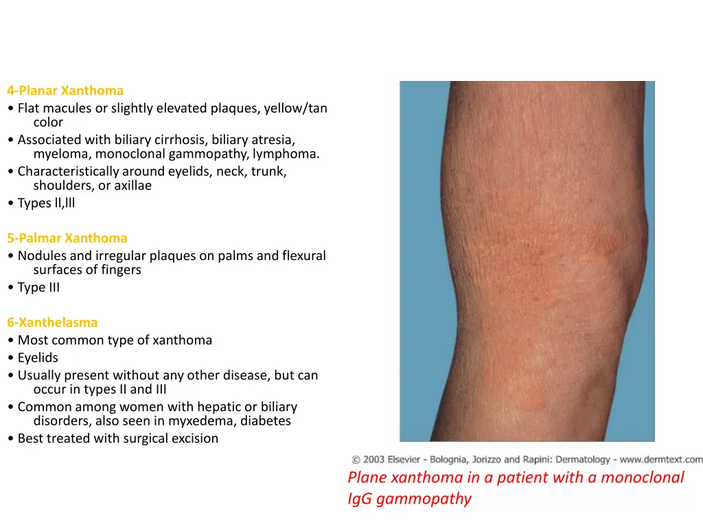 4 planar xanthoma flat macules or slightly