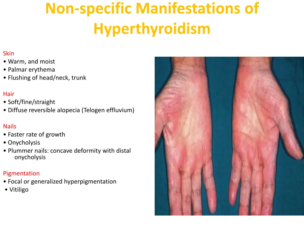 non specific manifestations of hyperthyroidism