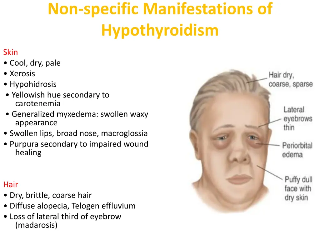 non specific manifestations of hypothyroidism