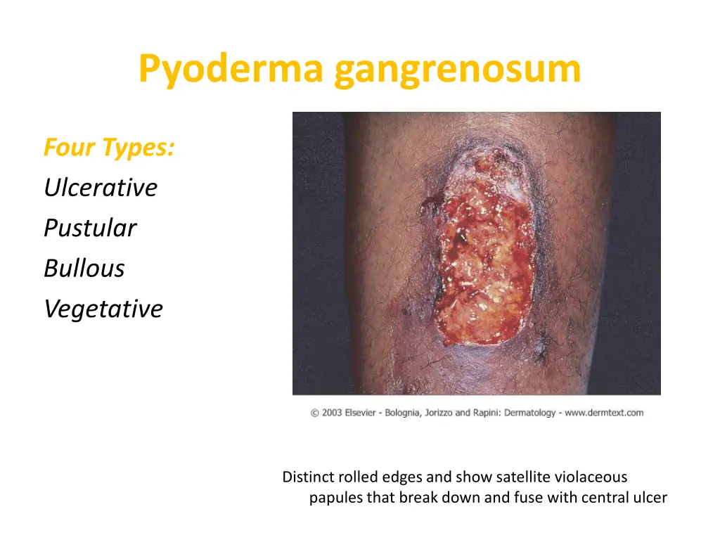 pyoderma gangrenosum