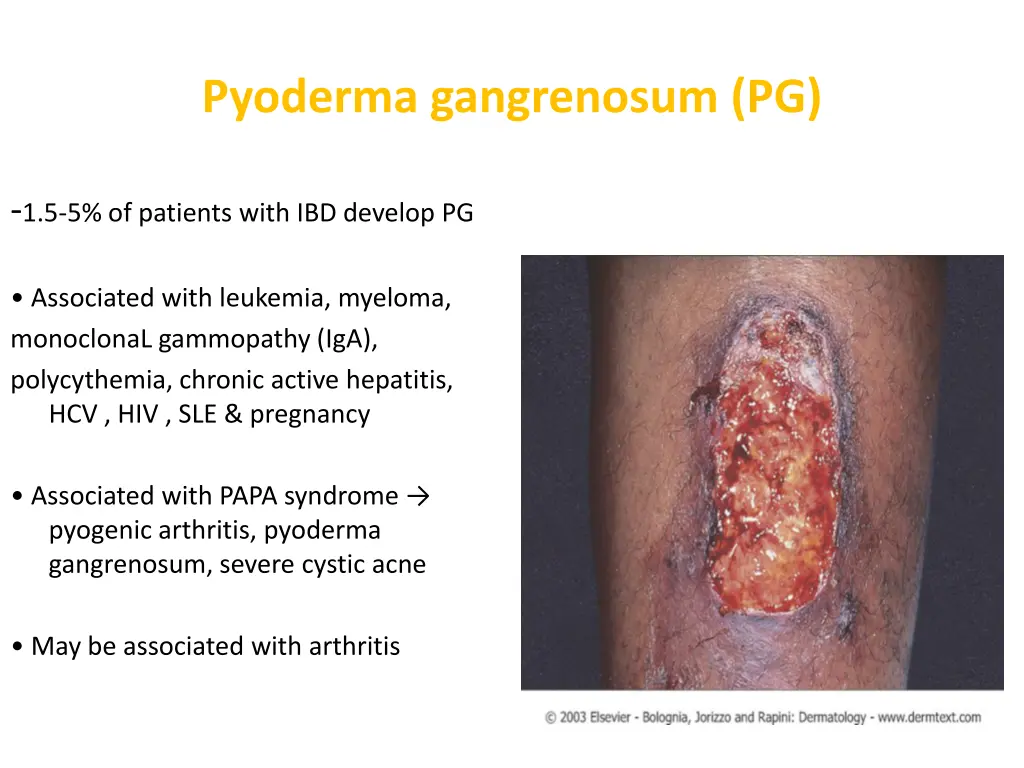 pyoderma gangrenosum pg