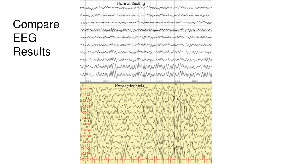 compare eeg results