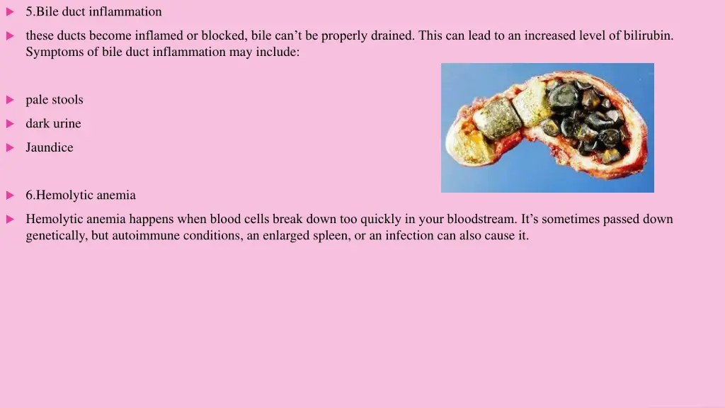 5 bile duct inflammation