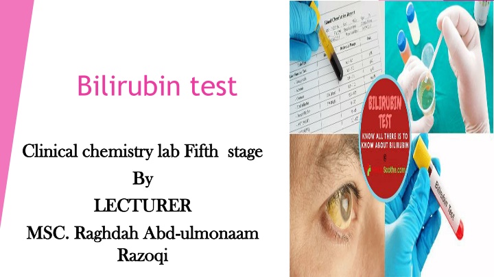 bilirubin test