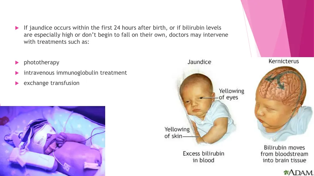 if jaundice occurs within the first 24 hours