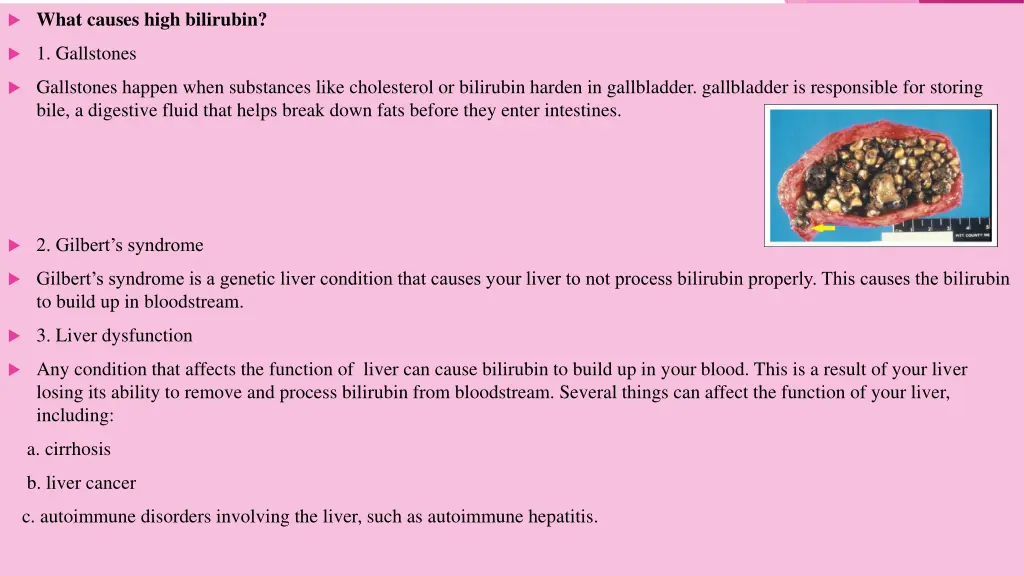 what causes high bilirubin