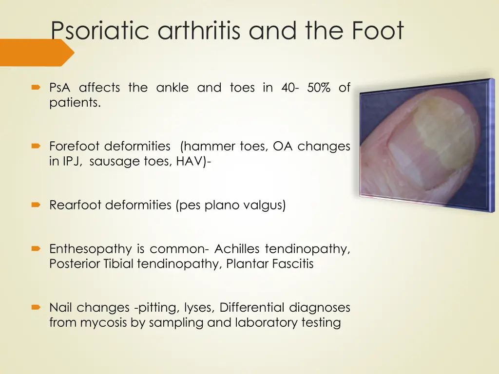 psoriatic arthritis and the foot