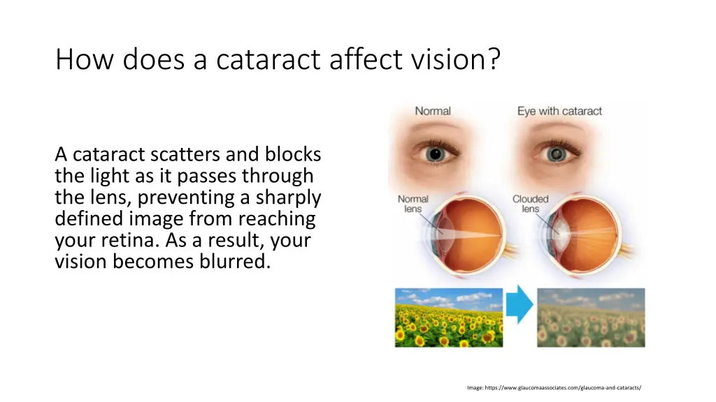 how does a cataract affect vision