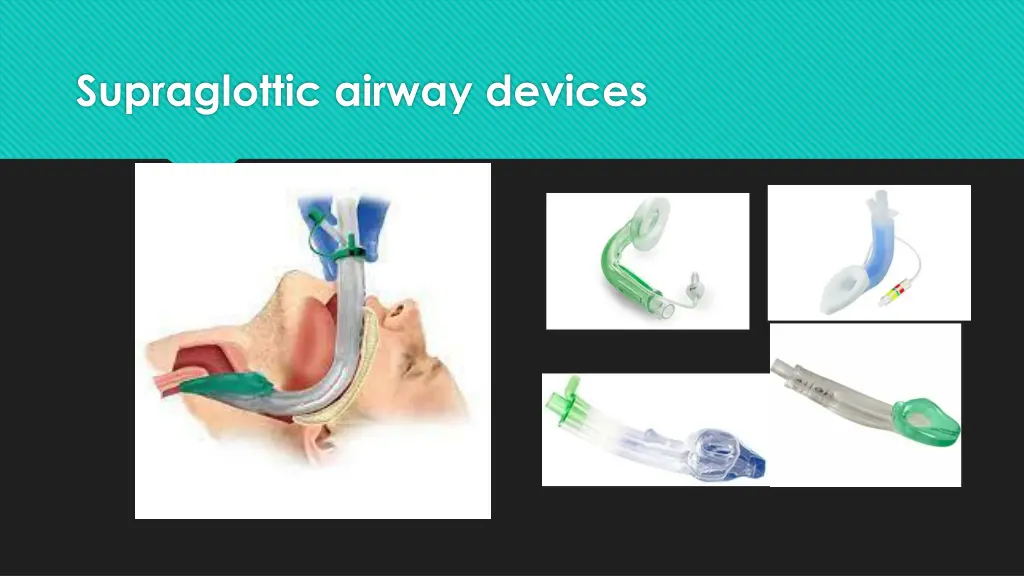 supraglottic airway devices