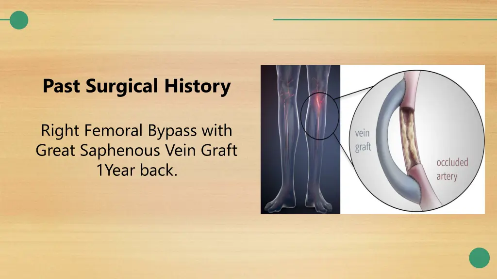 past surgical history