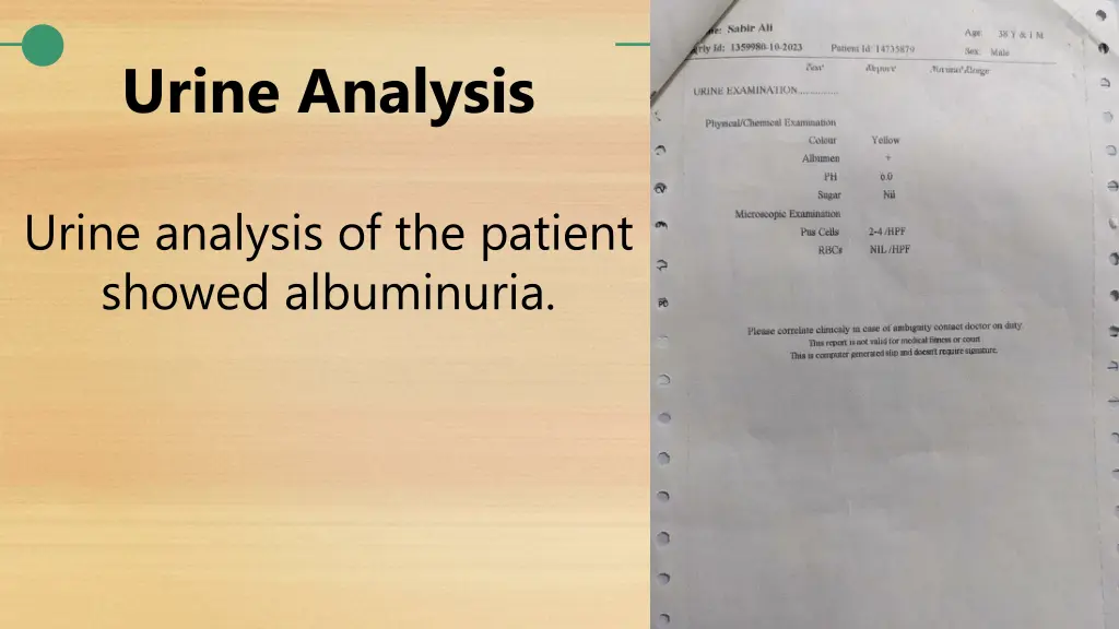 urine analysis