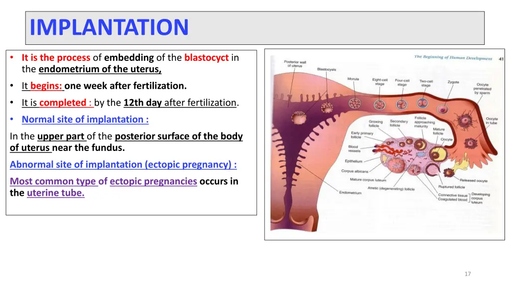 implantation