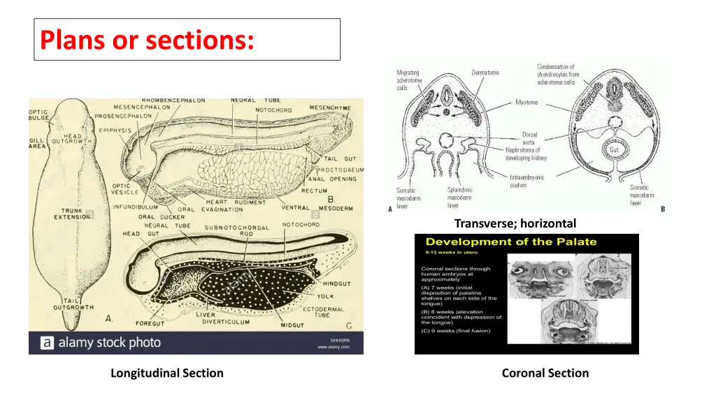 plans or sections