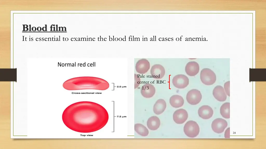 blood film it is essential to examine the blood