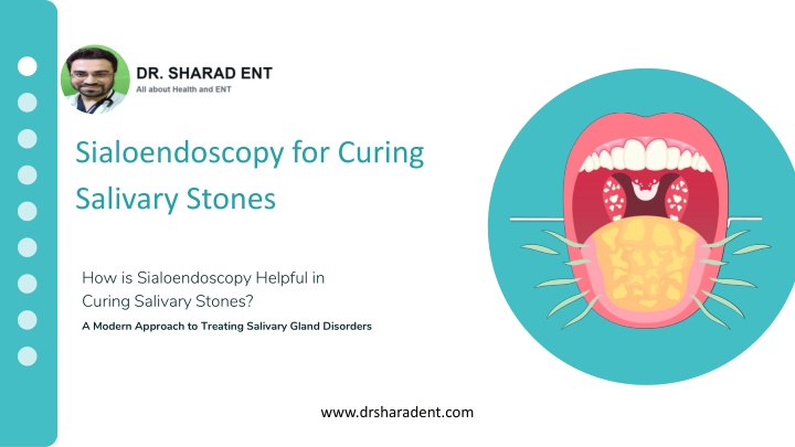 sialoendoscopy for curing salivary stones