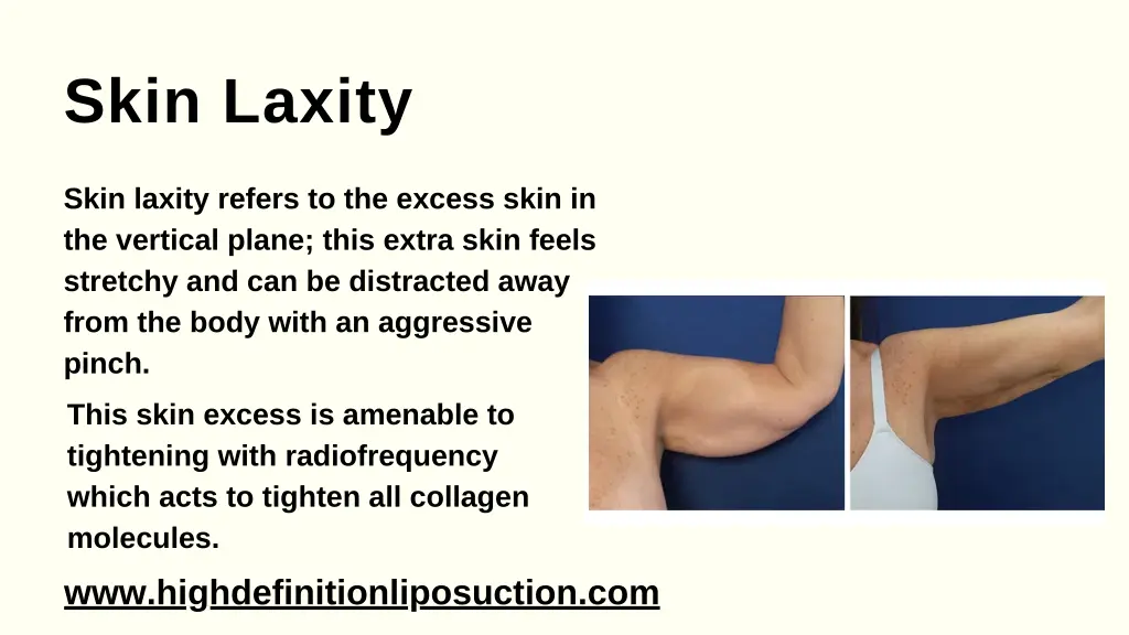 skin laxity