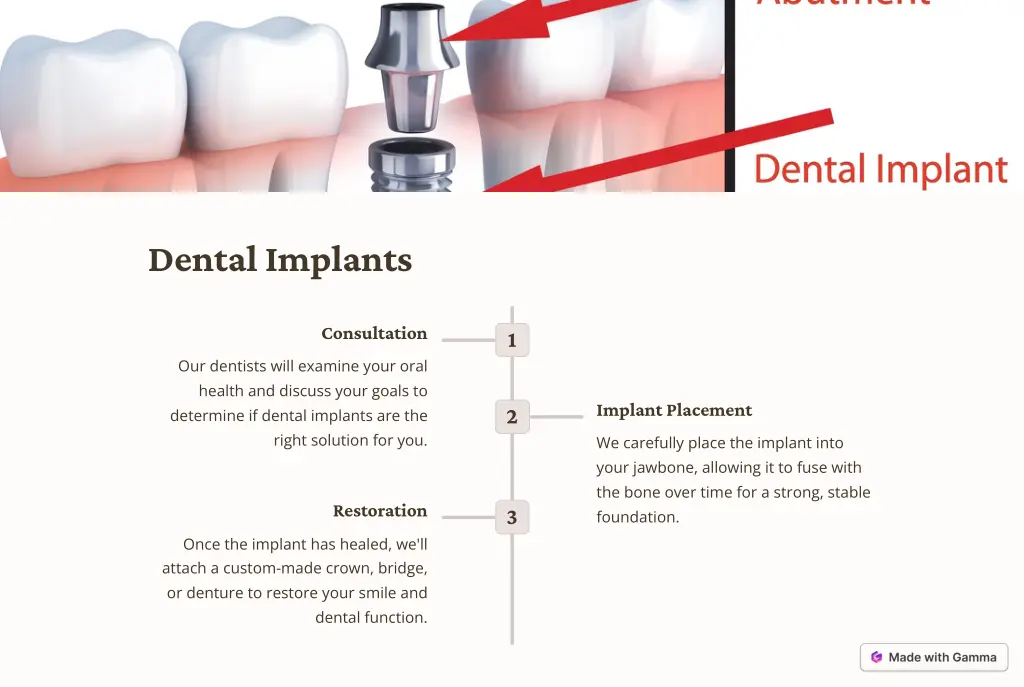 dental implants